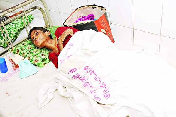 ঢাকা মেডিকেল কলেজ হাসপাতালের একটি শয্যায় গৃহকর্ত্রীর নির্যাতনে ক্ষতবিক্ষত আদুরি ছবি: প্রথম আলো