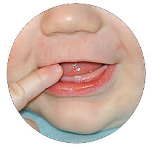 শিশুর দুধদাঁত