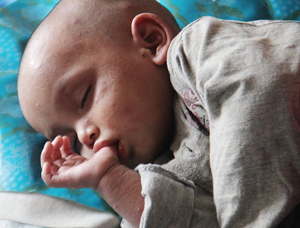 প্রচণ্ড জ্বরের ঘোরে আঙুল চুষতে চুষতে ঘুমিয়ে পড়েছে শিশুটি। ছবি: সাবিনা ইয়াসমিন