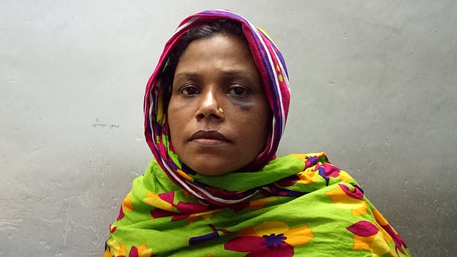 মামলার বাদী রাকিবের মা রীতা অভিযোগ করেন, পুলিশ তাঁর চোখের নিচে আঘাত করে। ছবি: আসাদুজ্জামান