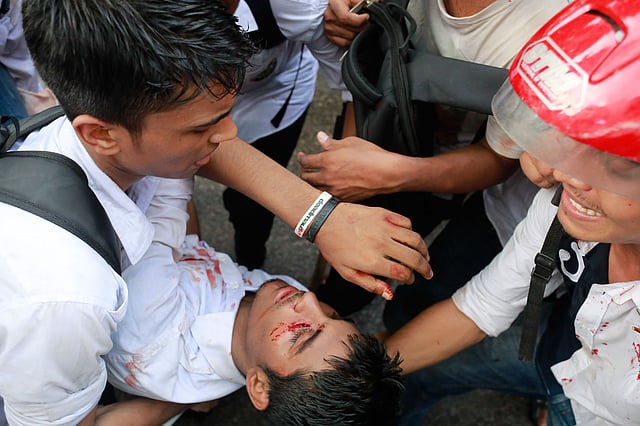 আহত এক শিক্ষার্থী। ছবি: শুভ্র কান্তি দাশ