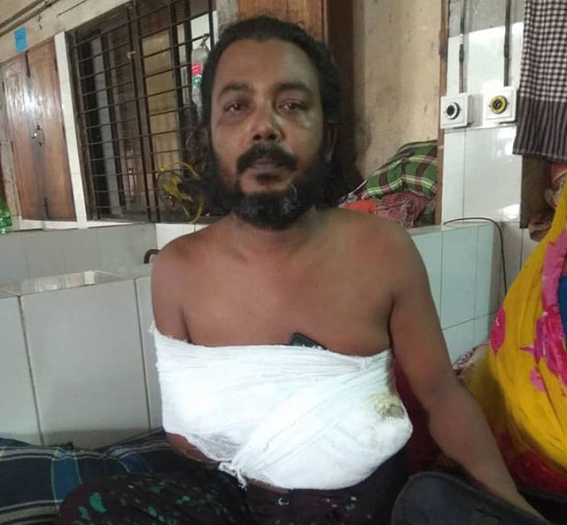 বিষধর গোখরার কামড় খেয়ে হাসপাতালে চিকিৎসাধীন সাপুড়ে খোকন। ছবি: প্রথম আলো