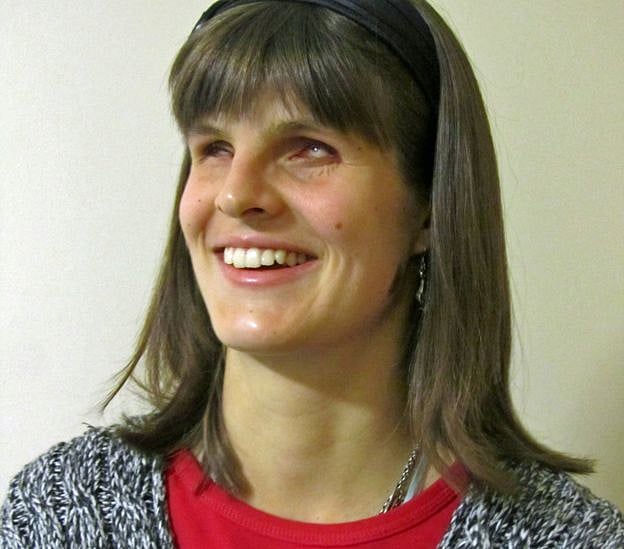 স্কুলজীবন থেকে একাকিত্বে ভোগেন দৃষ্টিপ্রতিবন্ধী মেগান পল। ছবি: বিবিসির সৌজন্যে