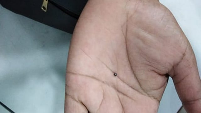 হাতের তালুতে গুলি দেখাচ্ছেন এক ব্যক্তি। ছবি: আরিফুজ্জামান