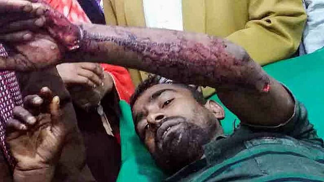 সুন্দরবনে মাছ ধরতে গিয়ে বাঘের আক্রমণের মুখে পড়েন মাসুম হাওলাদার (৩০)। এখন উপজেলা স্বাস্থ্য কমপ্লেক্সে চিকিৎসাধীন তিনি। ছবি: প্রথম আলো