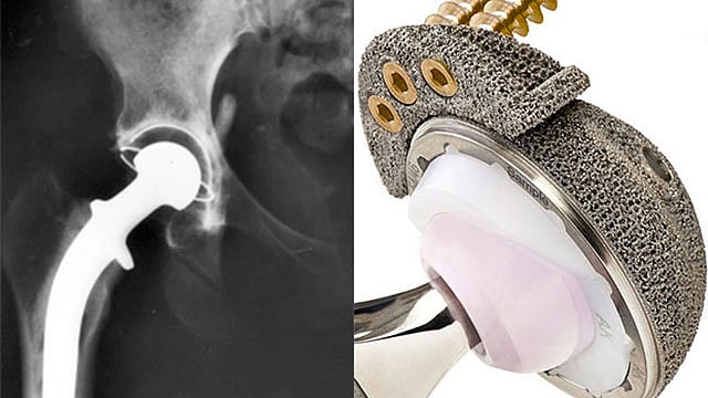 থ্রিডি প্রিন্টিং