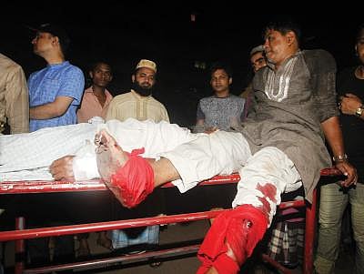 পুরান ঢাকার হোসেনি দালান এলাকায় গভীর রাতে বোমা হামলায় আহত ব্যক্তিদের একজন। ফাইল ছবি