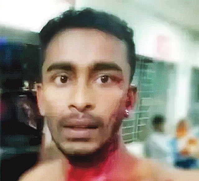 ২০১৯ সাল: ফরিদ হাসান হল সংসদে ছাত্রলীগের প্যানেল উপেক্ষা করে স্বতন্ত্র প্রার্থী হওয়ায় উর্দু বিভাগের ছাত্র ফরিদ হাসানকে গত ২ এপ্রিল পিটিয়ে রক্তাক্ত করেন ছাত্রলীগের নেতারা।