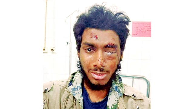 ২০১৮ সাল: এহসান রফিক, দুর্যোগ বিজ্ঞান ও ব্যবস্থাপনা বিভাগের শিক্ষার্থী এহসান রফিককে ২০১৮ সালের ৬ ফেব্রুয়ারি নির্যাতন করেন ছাত্রলীগের সাত নেতা। এতে তাঁর একটি চোখের কর্নিয়া ক্ষতিগ্রস্ত হয়।