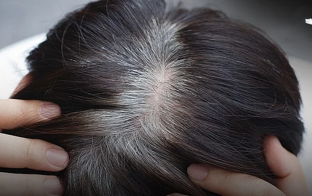 আমাদের চুলের গোড়ায় চলছে এক অদৃশ্য যুদ্ধ