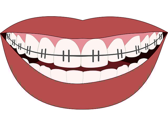 Image taken from Pixabay