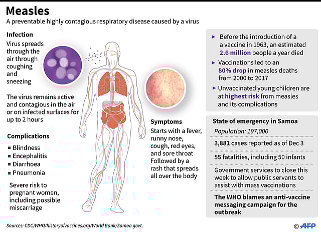 Factfile on measles, a highly contagious disease. An epidemic in Samoa has now claimed 55 lives, according to official data as of Tuesday. Photo: AFP