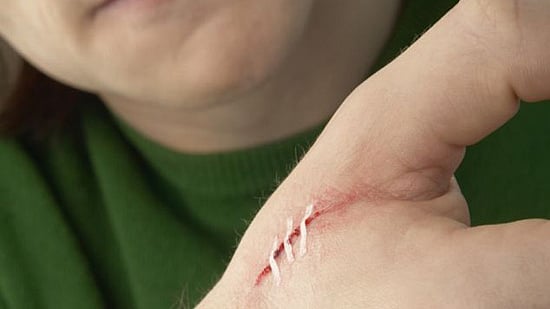 ক্ষত দীর্ঘস্থায়ী হতে পারে নানা কারণে