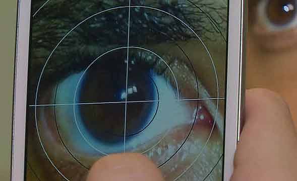 চোখ পরীক্ষায় ব্যবহার হবে স্মার্টফোন