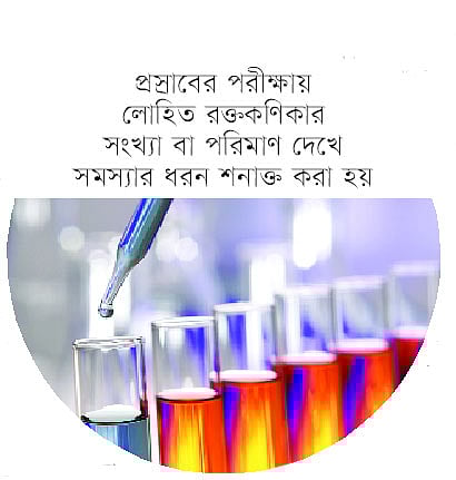 প্রস্রাবের রং লাল