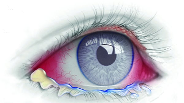 প্রতীকী ছবি