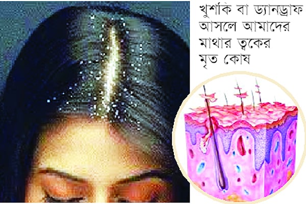 খুশকিনাশক শ্যাম্পু