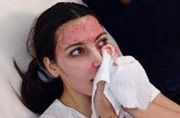 রক্ত-স্নান