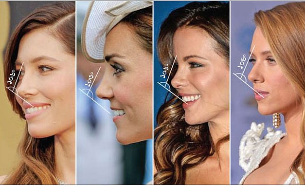 ছবিতে শ্বেতাঙ্গ সুন্দরীদের আদর্শ নাকের গঠন। বাঁ থেকে যথাক্রমে মার্কিন অভিনেত্রী জ্যাসিকা বিয়েল, ব্রিটিশ রাজবধূ কেট মিডলটন, ইংরেজ অভিনেত্রী কেট বেকিনসেল এবং মার্কিন অভিনেত্রী স্কারলেট জোহানসন। গবেষণা অনুযায়ী, তাঁদের নাক ‘সবচেয়ে নিখুঁত’