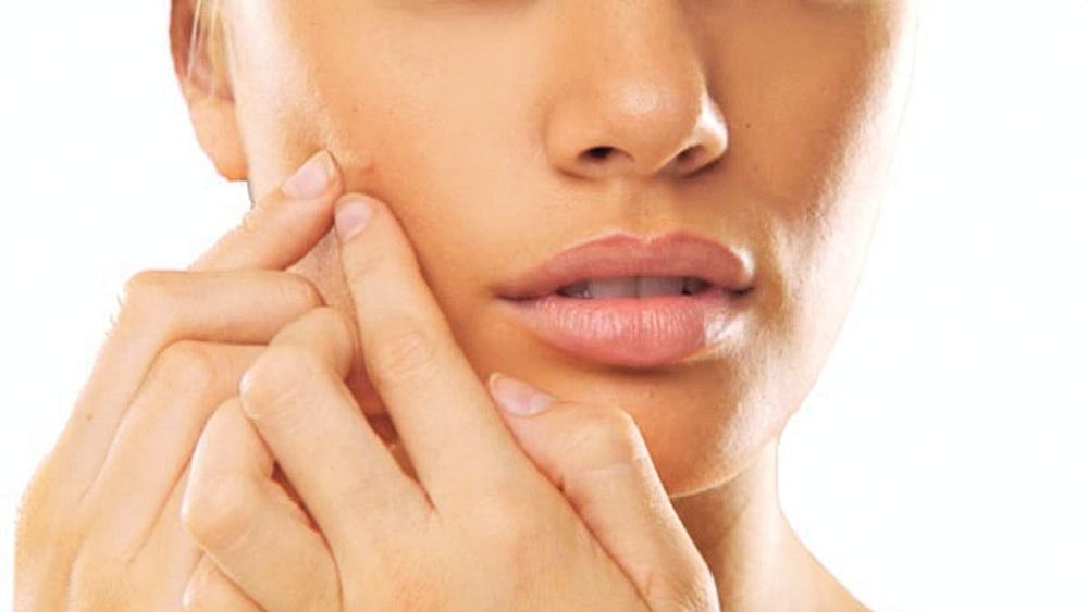 ব্রণ নিয়ে যত বিভ্রান্তি