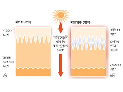 অতিবেগুনি রশ্মি এ অকালে বুড়িয়ে যাওয়া ও ক্যানসারের জন্য দায়ী