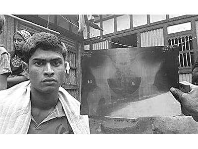 বালুদস্যুদের গুলিতে আহত মিসির আ​লী l প্রথম আলো