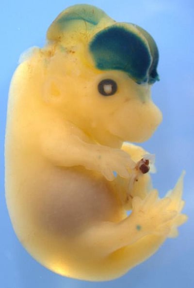 ইঁদুরের ভ্রূণের মধ্যে মানুষের জিনোম দেওয়া হয়েছে। এতে নীল অংশে মস্তিষ্কের কার্যকলাপ খালি চোখেই বোঝা যাচ্ছে।