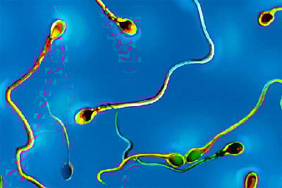 এই গবেষণার সুফল পেতে পারেন লাখ লাখ বন্ধ্যা পুরুষ l ছবি: অ্যালামি