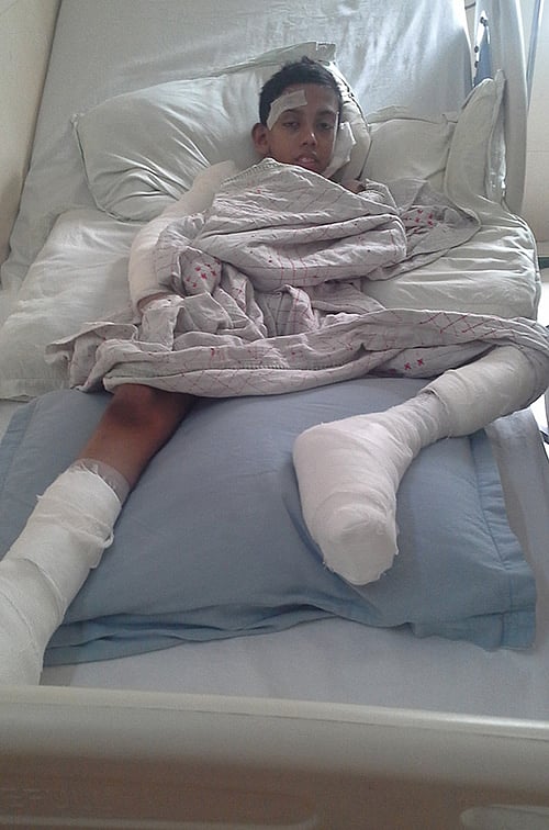 আদরের ভাইটিকে খুঁজছে দগ্ধ জারিফ