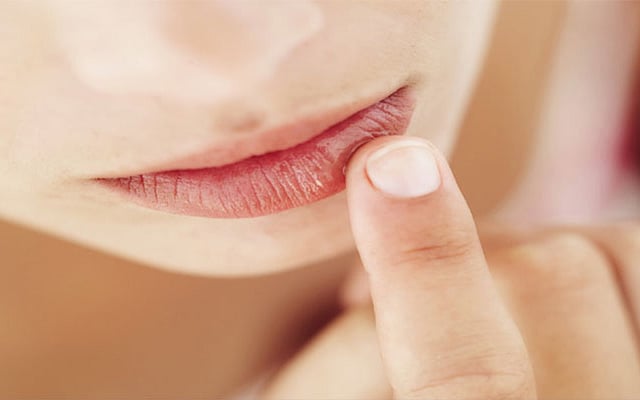 ছবি: ঠোঁট ফাটা ঠেকাতে নারকেল তেল লাগাতে পারেন। প্রতীকী ছবি।