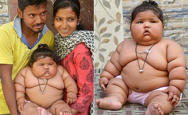 চাহাত কুমার। শিশুটির বয়স মাত্র আট মাস। এই বয়সেই তার ওজন ১৭ কেজি। ছবি: এএফপি