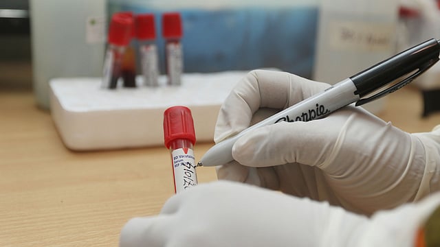 ডেঙ্গু, চিকুনগুনিয়া রোগ শনাক্ত করতে রক্তের নমুনা সংগ্রহ করছে রাজধানীর মহাখালীর আইইডিসিআর। ছবিটি আজ সোমবার তোলা। ছবি: আবদুস সালাম