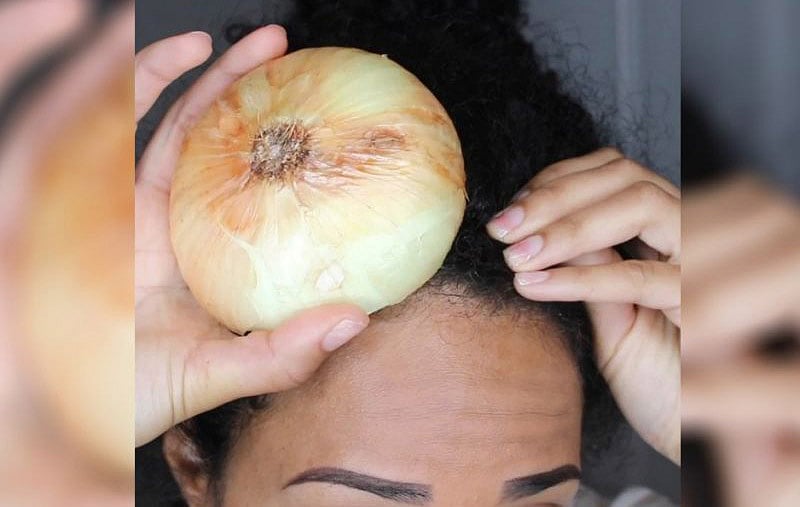 চুল পড়া রোধে পেঁয়াজ বেশ কার্যকর। ছবি: ইয়াহু