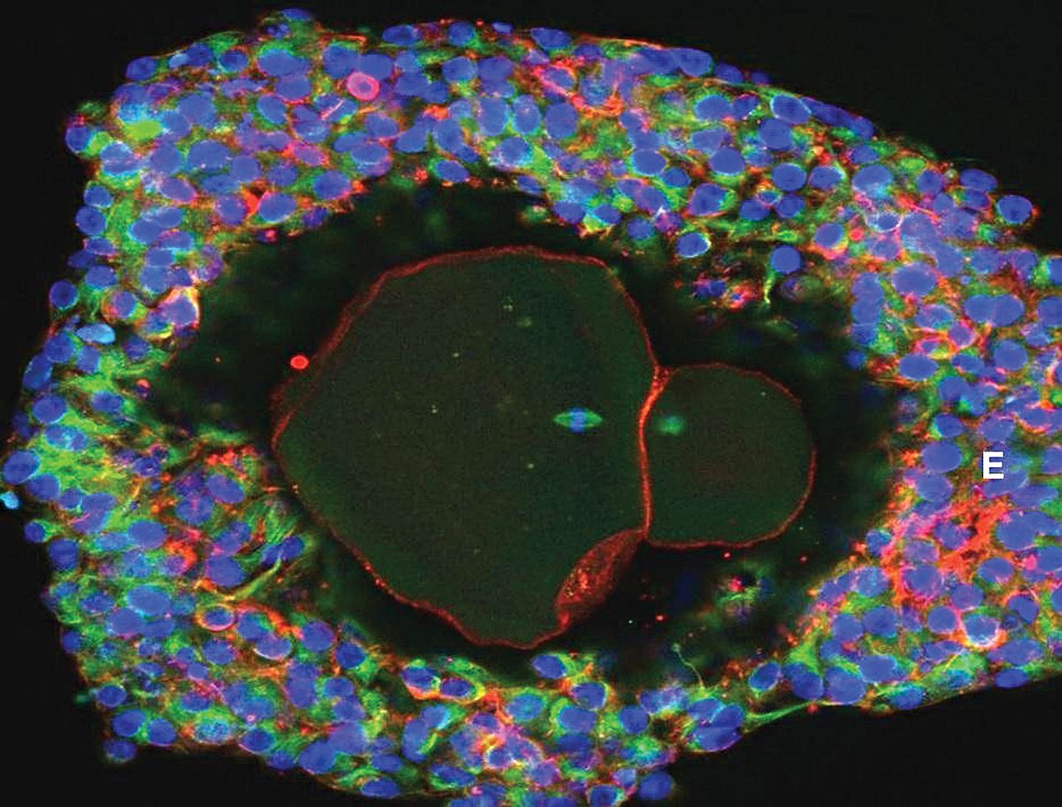 গবেষণাগারে মানব ডিম্বাণু