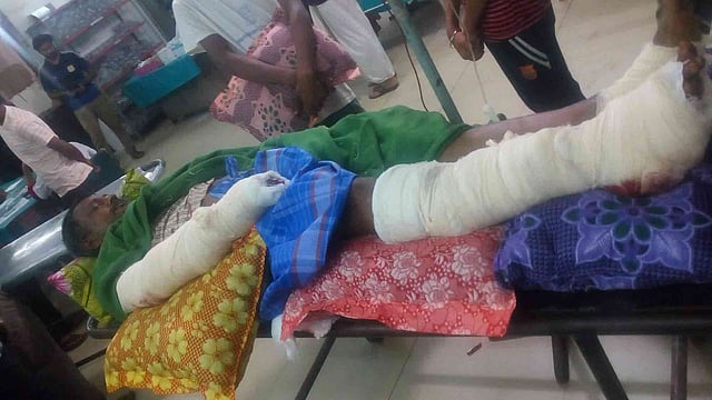 ট্রাক চাপায় কালু দাসের ডান পা ও ডান হাত থেঁতলে গেছে। তিনি ঢাকা মেডিকেল কলেজ হাসপাতালে ভর্তি আছেন। ছবি: প্রথম আলো