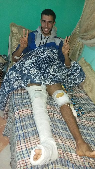 দুই হাঁটুতে গুলির জখম নিয়ে সাবেক ফুটবলার মোহাম্মদ খলিল। ছবি: টুইটার