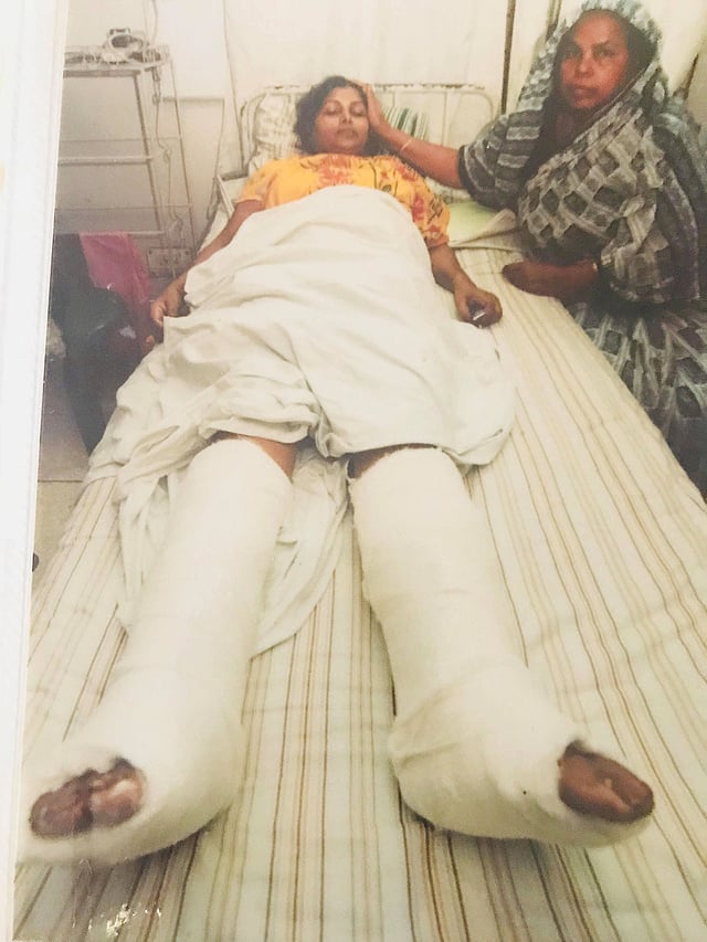 একুশে আগস্টের বর্বর হামলায় আহত হয়ে হাসপাতালের বিছানায় নীলা চৌধুরী। ছবি: সংগৃহীত
