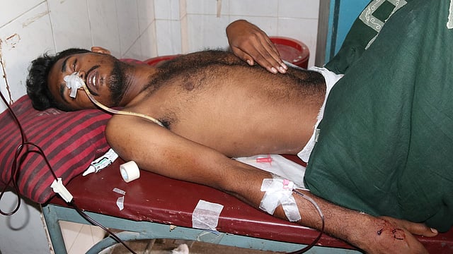 গরম পানিতে ঝলসে যাওয়া চিকিৎসাধীন মোয়াজ্জেম হোসেন। রাজশাহী, ২৭ সেপ্টেম্বর। ছবি: শহীদুল ইসলাম