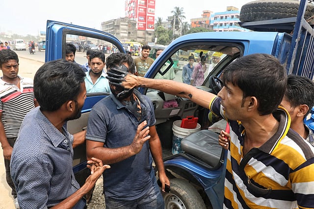 এক চালকের মুখে পোড়া ইঞ্জিন ওয়েল। ছবি: দীপু মালাকার