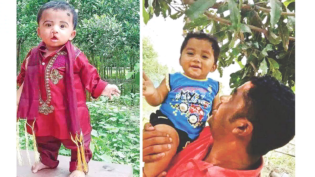 ছোট্ট তাহেদুল জন্ম থেকেই ছিল ঠোঁটকাটা। অপারেশন ক্লেফটের মাধ্যমে বিনা মূলে্য অস্ত্রোপচারের পর সুস্থ হয়ে হাসি ফিরে পায়। সংগৃহীত