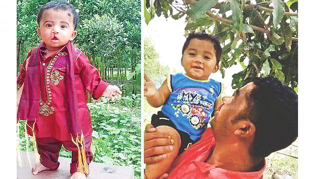 ছোট্ট তাহেদুল জন্ম থেকেই ছিল ঠোঁটকাটা। অপারেশন ক্লেফটের মাধ্যমে বিনা মূলে্য অস্ত্রোপচারের পর সুস্থ হয়ে হাসি ফিরে পায়।  সংগৃহীত