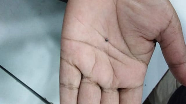 সংঘর্ষে হাতের তালুতে প্যালেট বুলেট দেখাচ্ছেন এক ব্যক্তি। ছবি: আরিফুজ্জামান