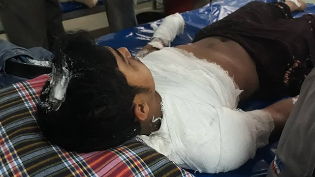 ঢাকা মেডিকেল কলেজ হাসপাতালের বার্ন ইউনিটে চিকিৎসাধীন একজন। ঢাকা, ২৩ নভেম্বর। ছবি: আবদুস সালাম