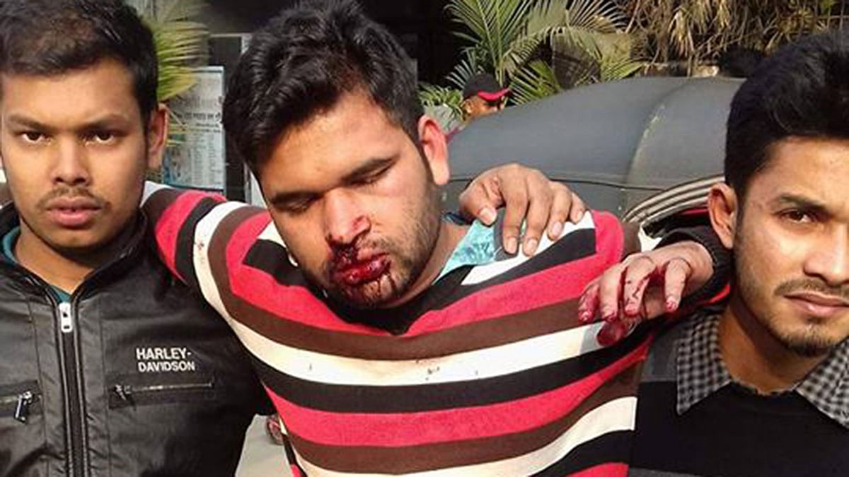 টিএসসি এলাকায় হামলায় রক্তাক্ত কোটা সংস্কার আন্দোলনের নেতা সোহরাব হোসেন। গণস্বাস্থ্য নগর হাসপাতাল, ধানমন্ডি, ঢাকা, ২৩ ডিসেম্বর। ছবি: প্রথম আলো