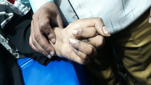 স্নাতকপড়ুয়া ছাত্রীকে দুই বছর পর অন্ধকার ঘর থেকে উদ্ধার করে হাসপাতালে চিকিৎসা দেওয়া হচ্ছে। নবাবগঞ্জ, দিনাজপুর, ৬ ফেব্রুয়ারি। ছবি: এ এস এম আলমগীর