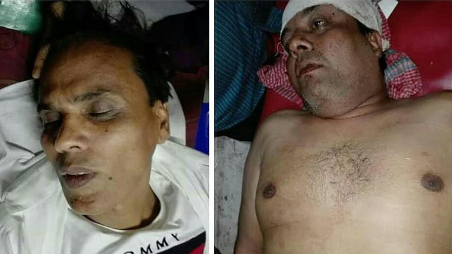 পিরোজপুরের মঠবাড়িয়ায় প্রতিপক্ষের হামলায় আহত হোসাইন মোশারেফ সাকু ও রিয়াজুল আলম
