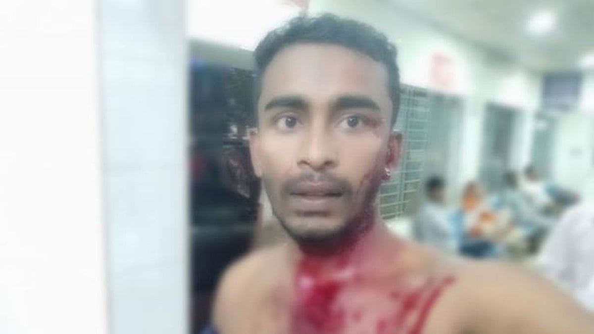 মারধরের শিকার ঢাকা বিশ্ববিদ্যালয়ের ছাত্র ফরিদ হাসান। ছবি: সংগৃহীত