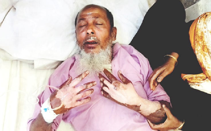 আহত সিরাজ সরদার।