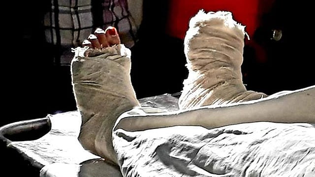 হাসপাতালে চিকিৎসাধীন মাদ্রাসাছাত্রী। ঢাকা মেডিকেল, ০৬ এপ্রিল। ছবি: আহমেদ জায়িফ