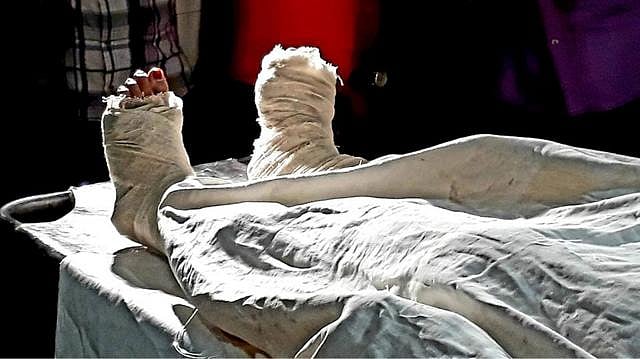 হাসপাতালে চিকিৎসাধীন মাদ্রাসাছাত্রী। ঢাকা মেডিকেল, ০৬ এপ্রিল। ছবি: আহমেদ জায়িফ